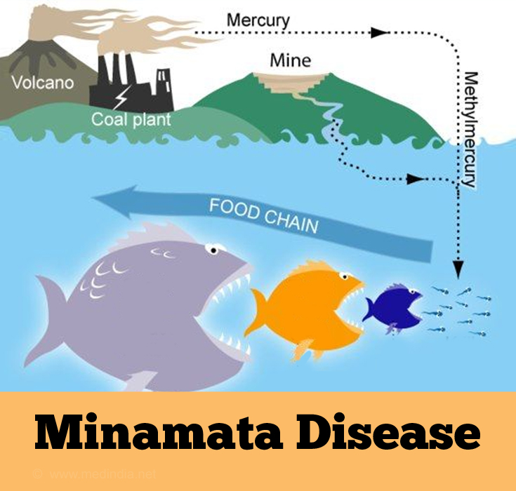 Minamata Disease Causes Symptoms Signs Diagnosis Treatment