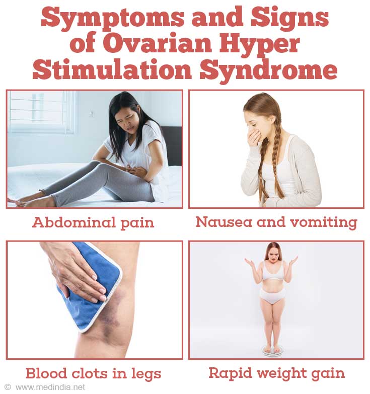 Ovarian Hyper Stimulation Syndrome Ohss Causes Symptoms Diagnosis