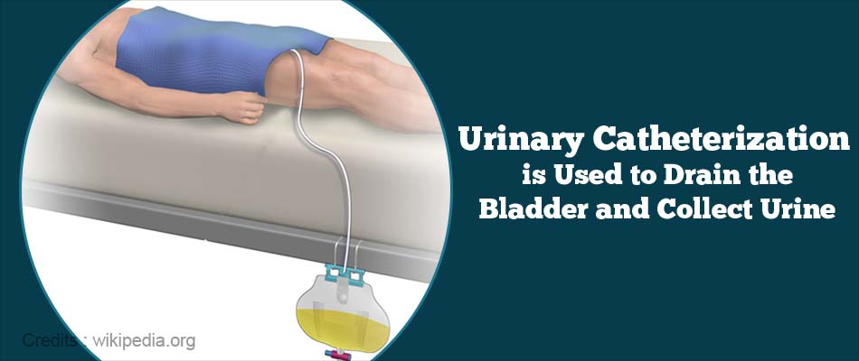 Urinary Retention Types Causes Symptoms Diagnosis Treatment Prevention