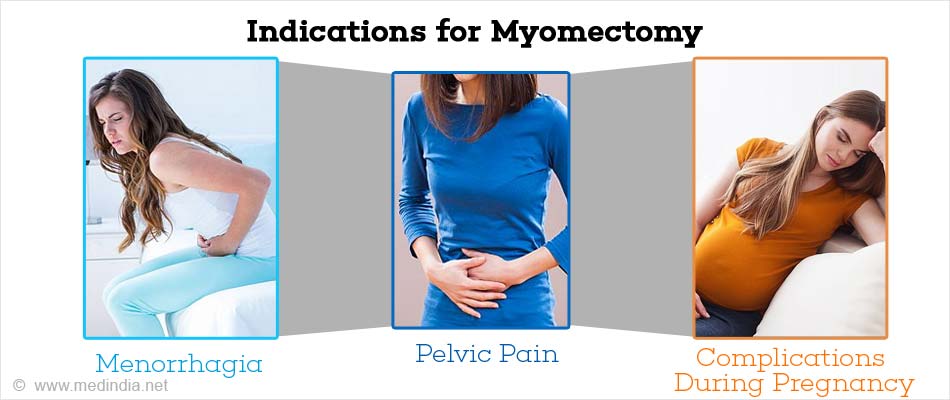 Myomectomy Indications Types Preparation Procedure Complications
