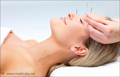 Treatment of Traditional Chinese Medicine: Acupuncture Treatment of Traditional Chinese Medicine: Acupuncture