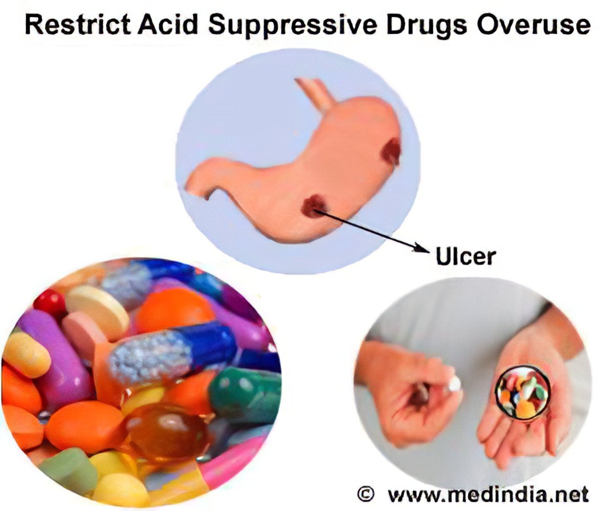 Mayo Clinic Pharmacy Residency Programs on X quotDefinitions of stress ulcer  bleeding is on a continuum which is important for interpreting the clinical  significance of a stress ulcer httpstco19pjSe9qYWquot  X