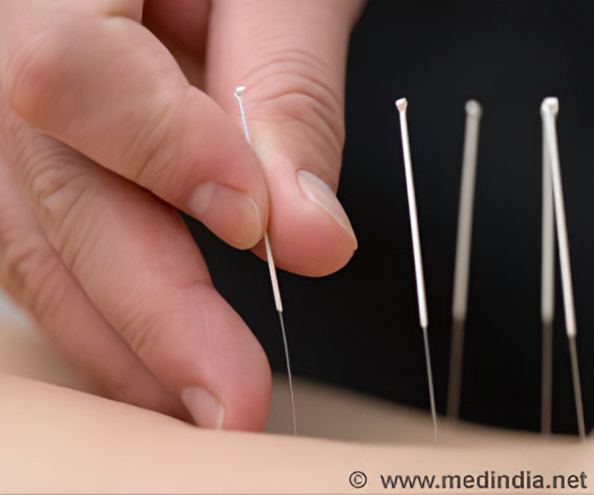 Acupuncture for Tinnitus: The Science Behind a Helpful Treatment - Heal.me