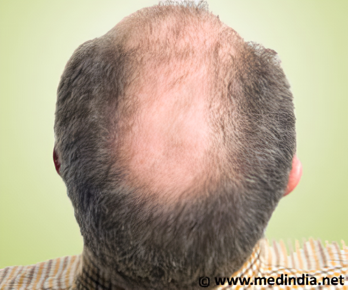 Hair Growth in Dormant Hair Follicles Could be Restarted by Activating  Pathway