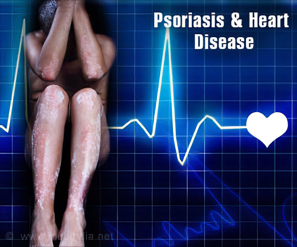 psoriasis and heart disease)