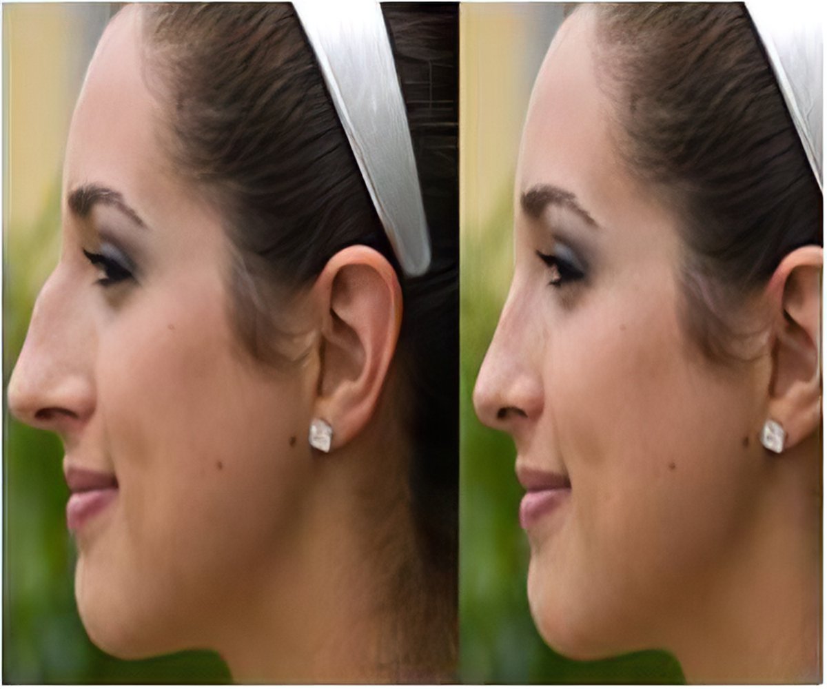Правильная форма носа у женщин фото