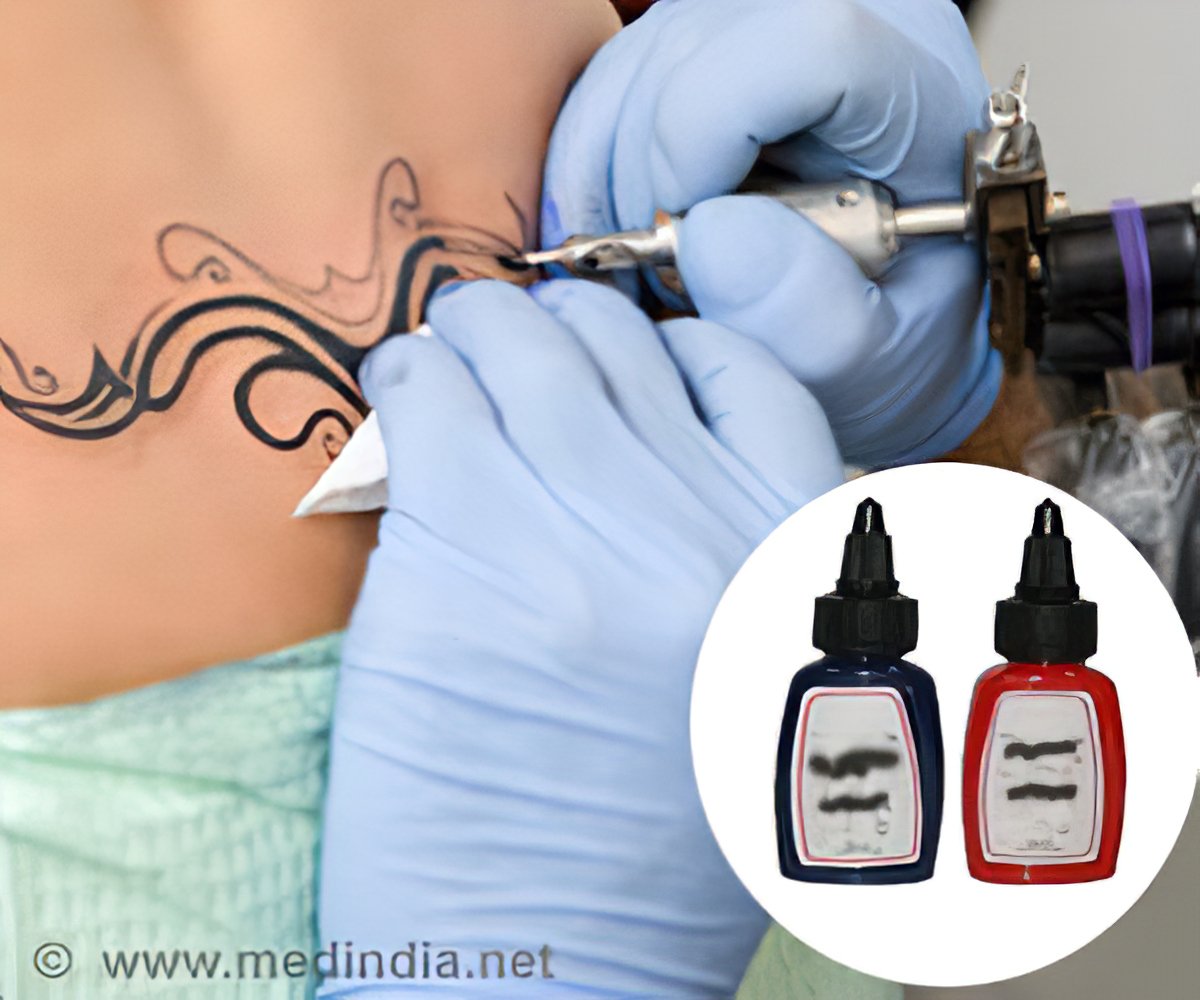 Does Tattoo Removal Cause Cancer  Removery