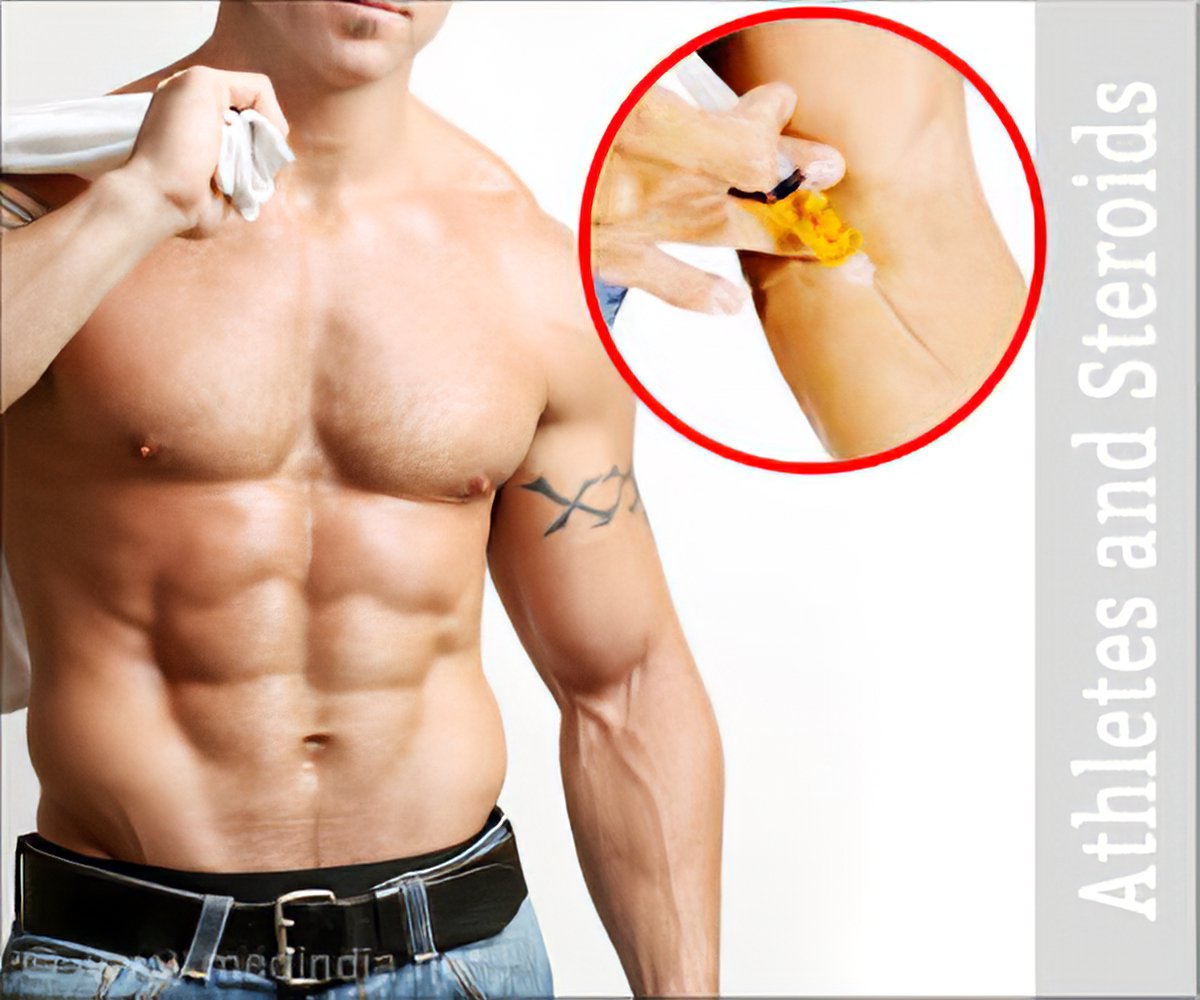 anabolic steroids side effects list