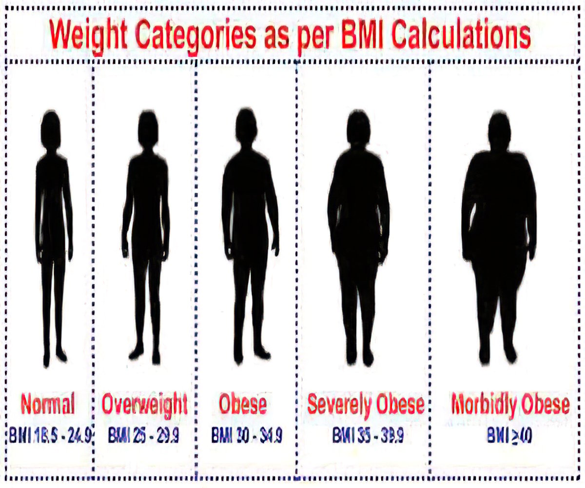 What Is Considered Morbidly Obese Chart