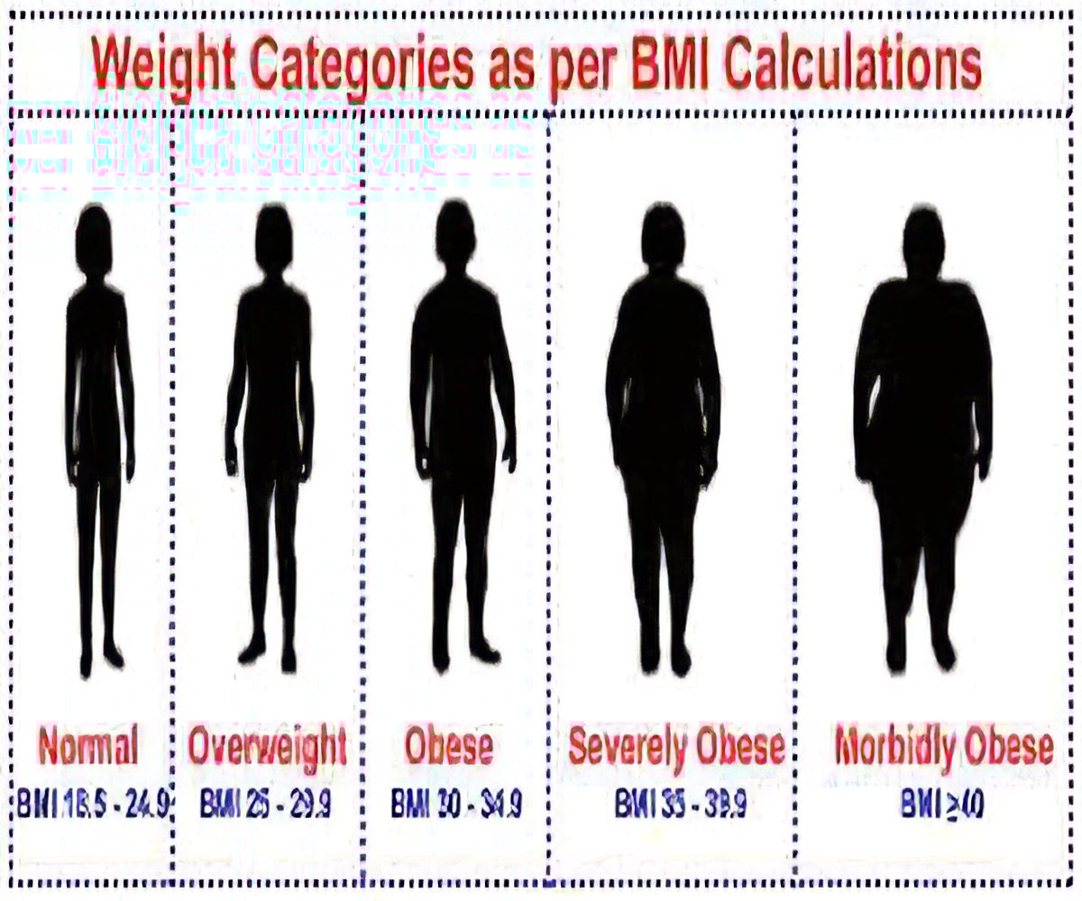 Bmi