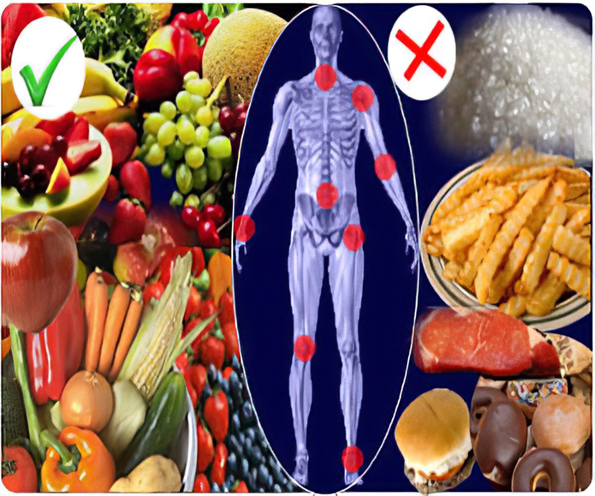 Rheumatoid Arthritis Food Chart