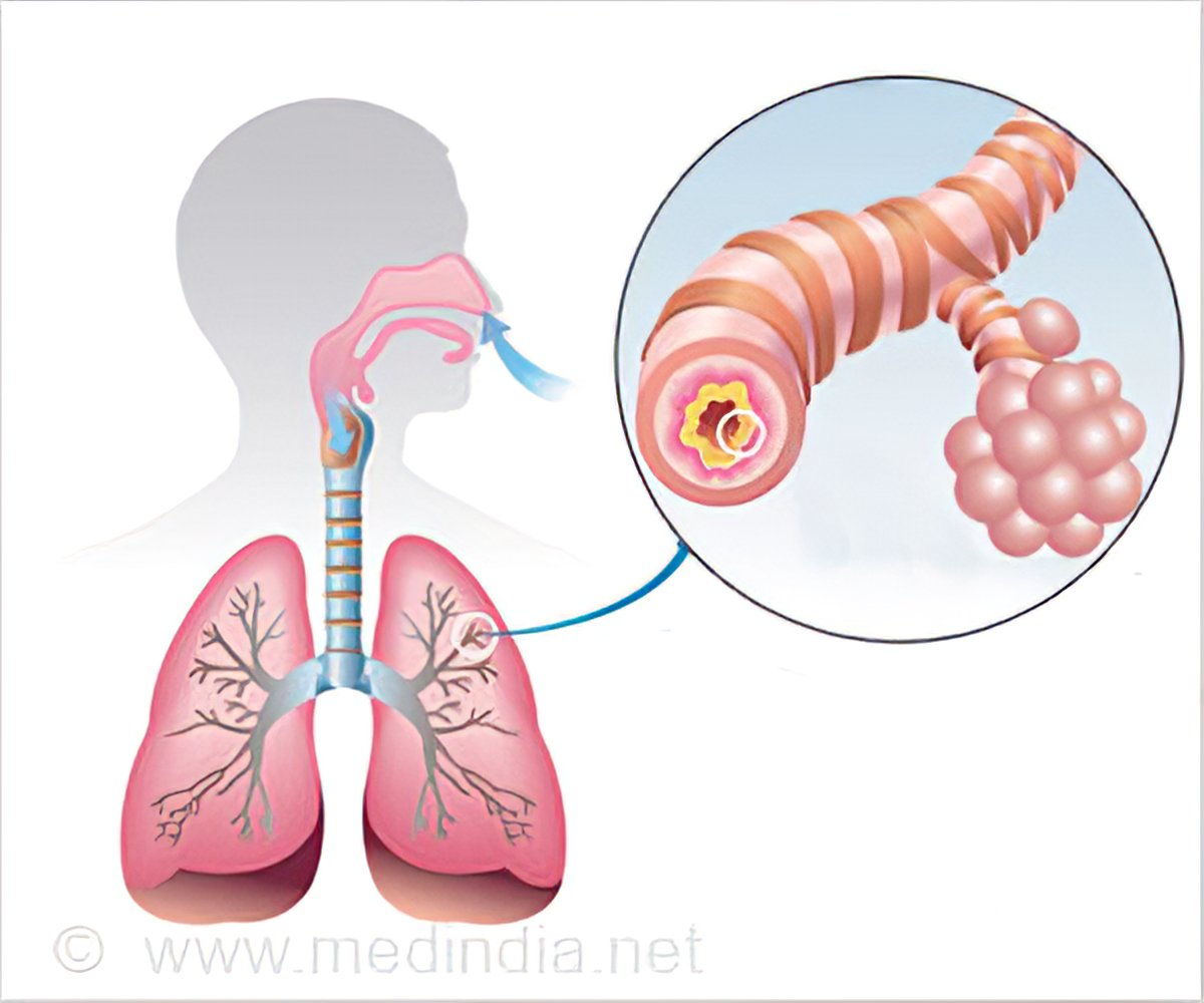 chronic abstracted pulmonary disease - dixe - cosmetics