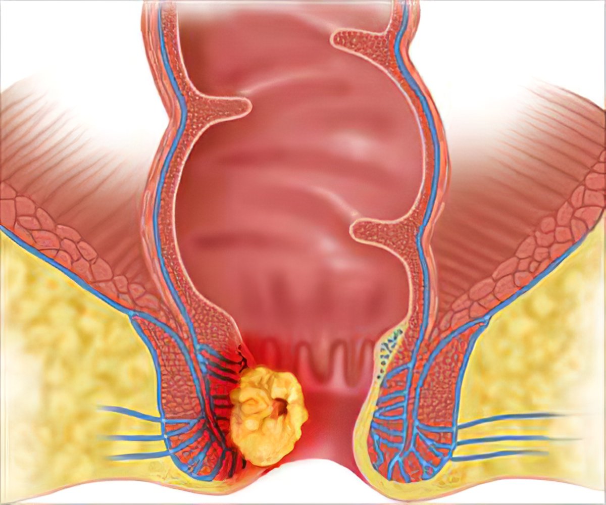 Anatomy of the Rectum and Anal Canal | turkcerrahi.com/en