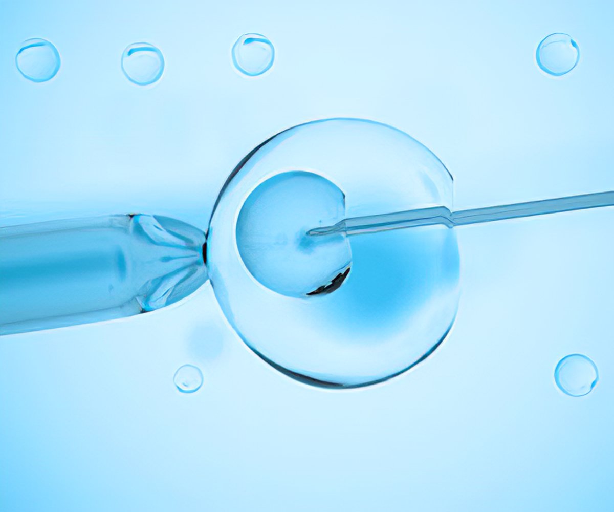 Assisted Reproductive Technologies - Types, Preparation, Procedure & Risk Factors