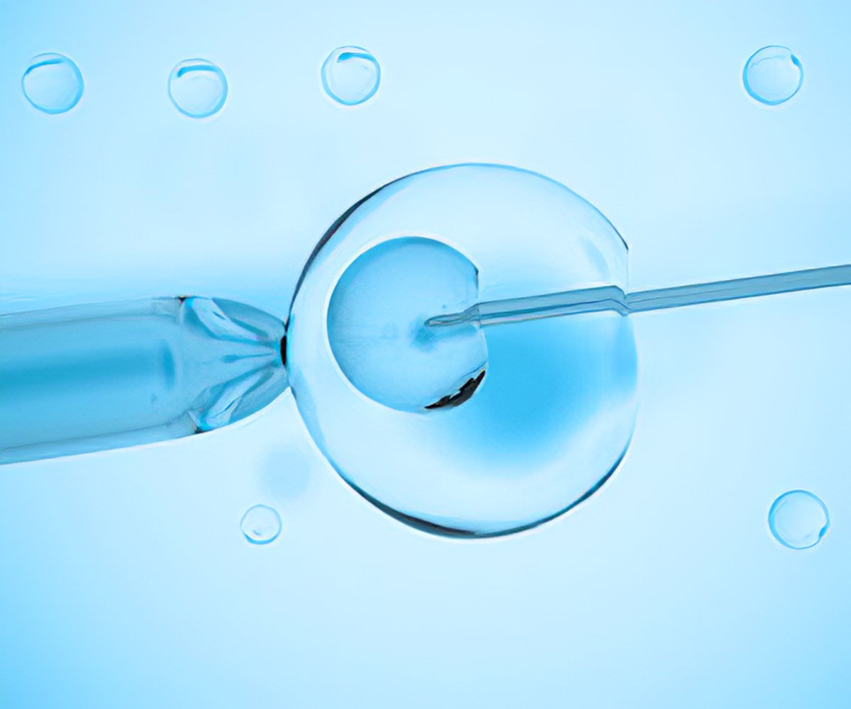 PDF) Assisted Reproductive Technology in Iran: The First National Report on  Centers, 2011