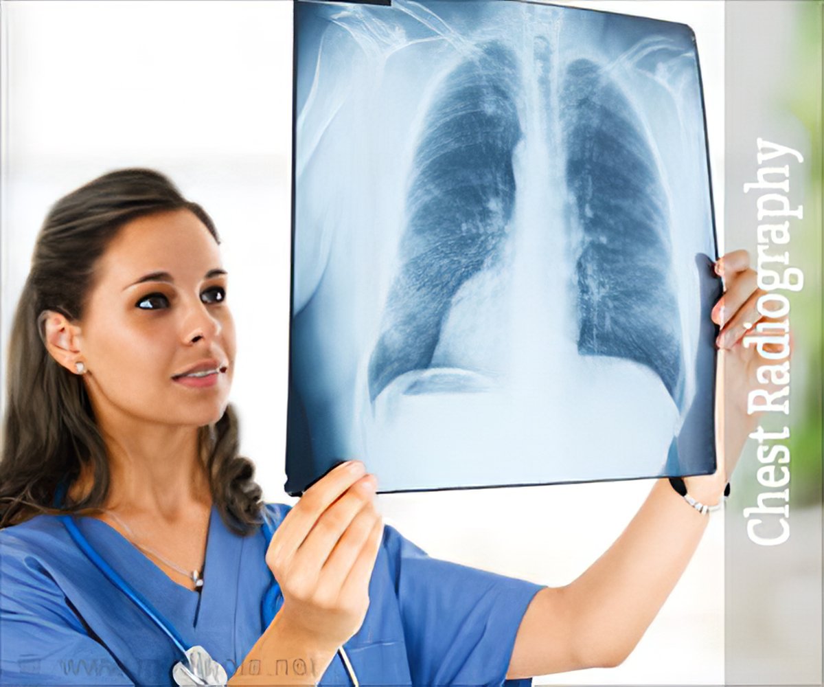 Chest Radiography | Chest X-ray Radiography