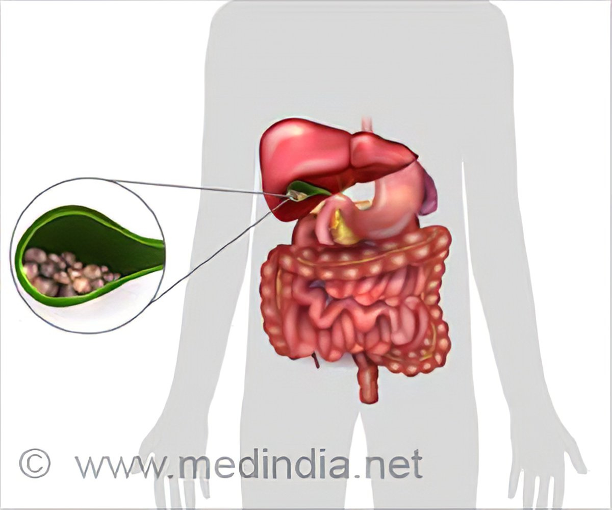 Cholecystitis | Inflammation of the Gall Bladder - Causes, Symptoms,  Treatment, Diagnosis and Prevention