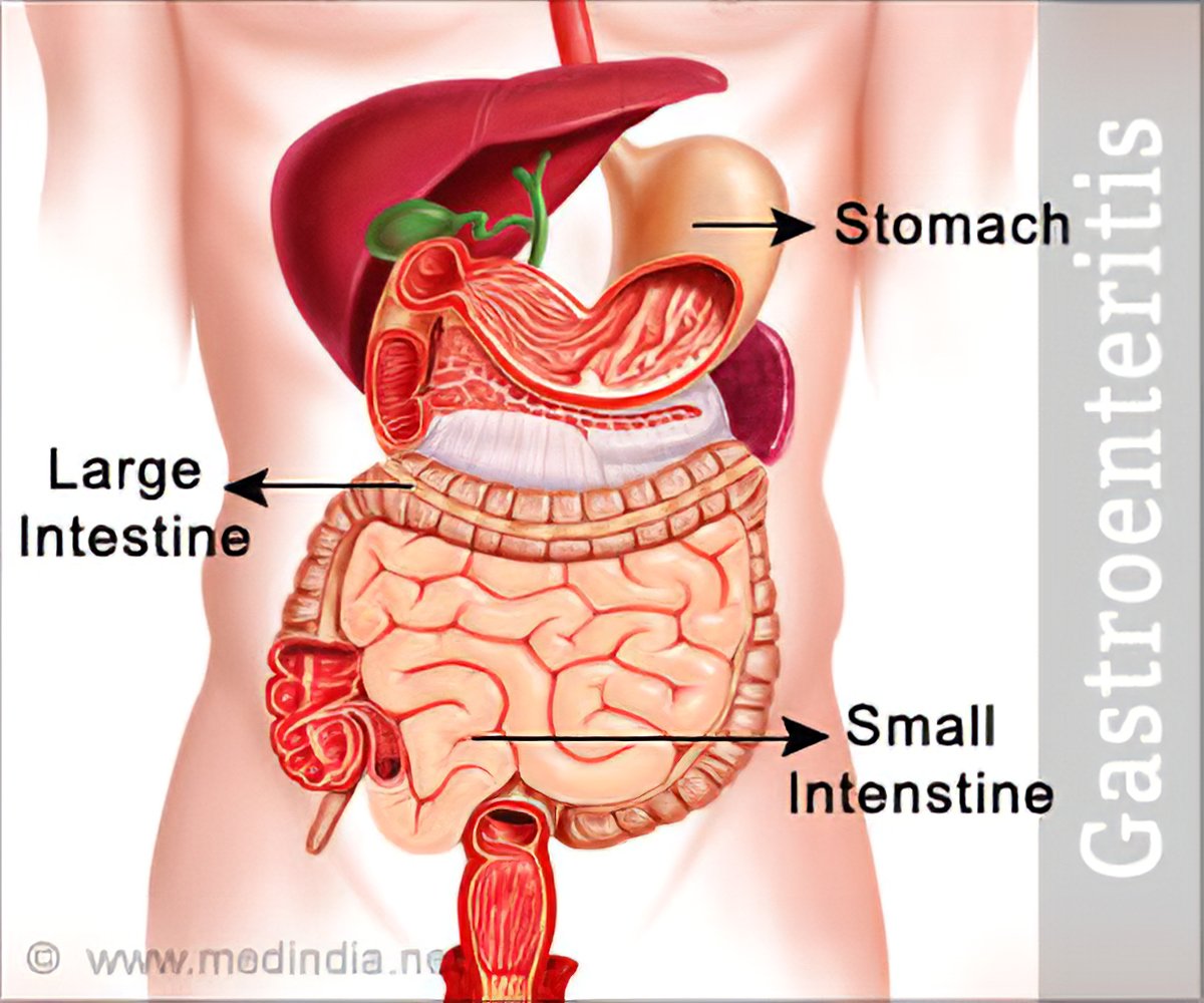 Gastroenteritis Stomach Flu Causes Symptoms Diagnosis Treatment Prevention