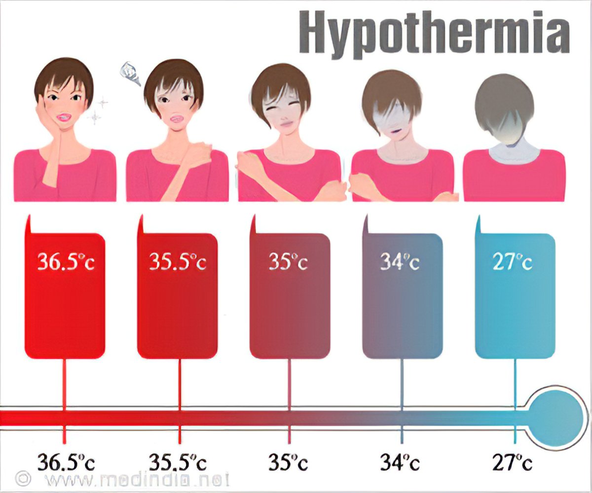 Shown are the body-temperature curve in the hypothermia (blue) and