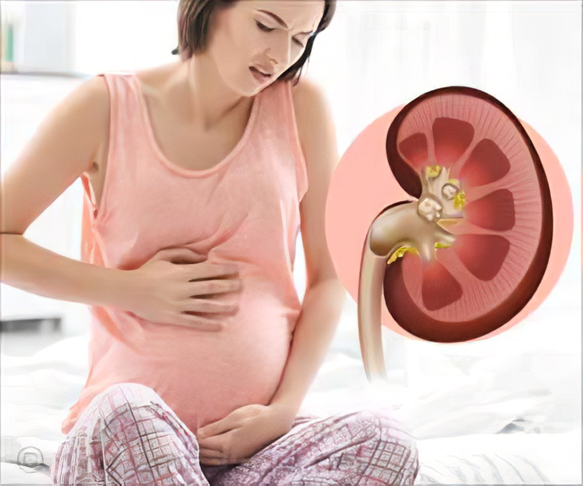 How To Prevent Or Solve Kidney Problems Kidney Stones During Pregnancy 