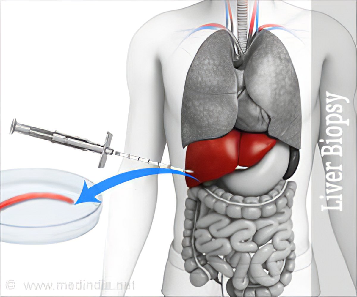 liver-biopsy-references