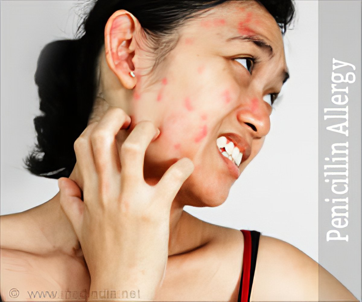 Сильное жжение у женщин. Аллергическая реакция на лице.