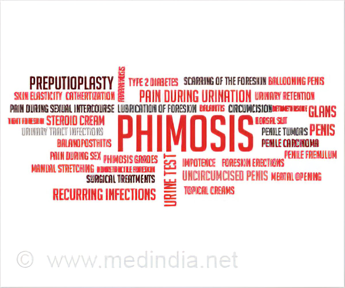Phimose hydrocortison How to