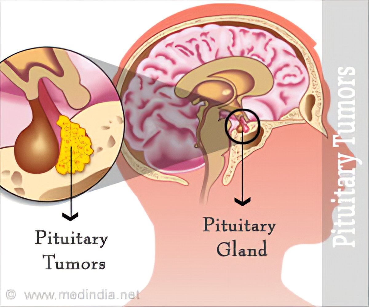 what does a tumor on the pituitary gland on a dog mean