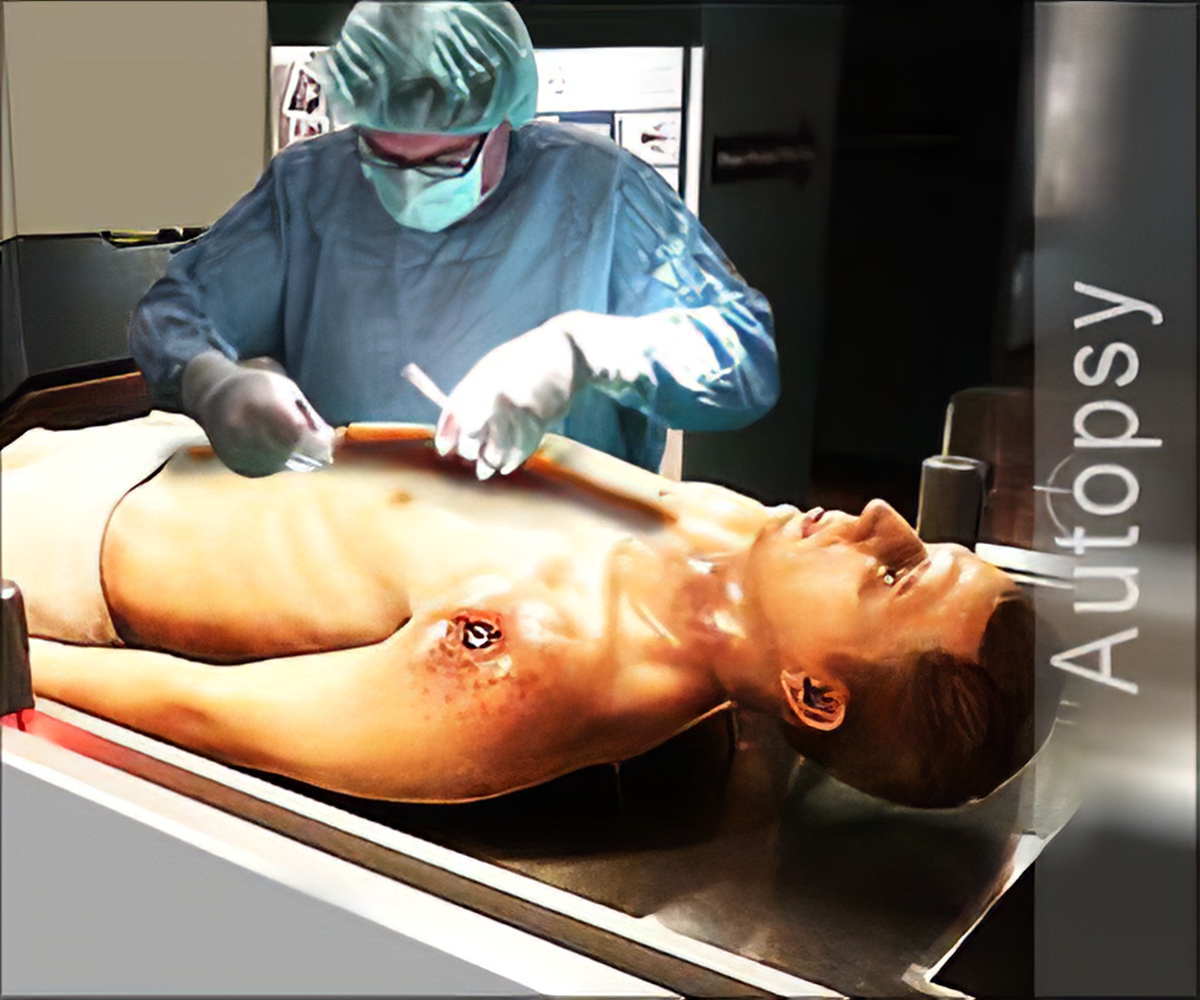 Frequently Asked Questions On Post-mortem (or Autopsy