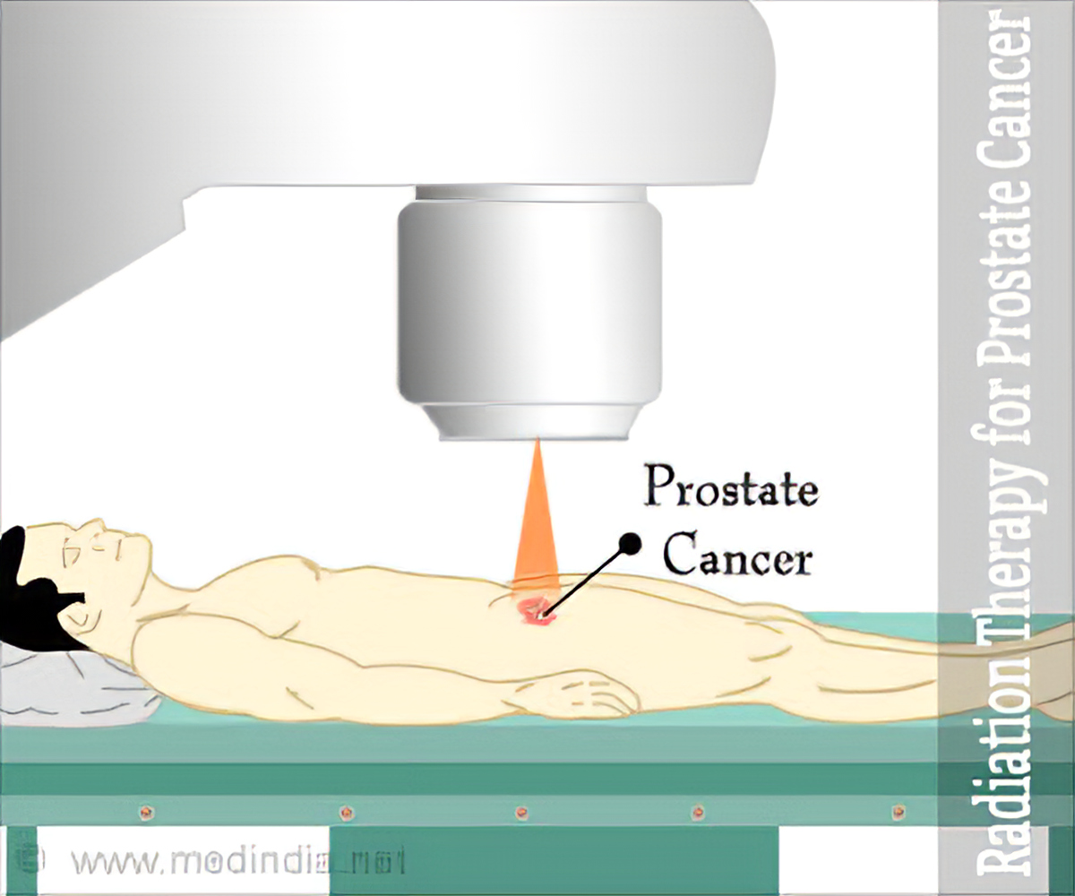 How long does proton therapy for prostate cancer take