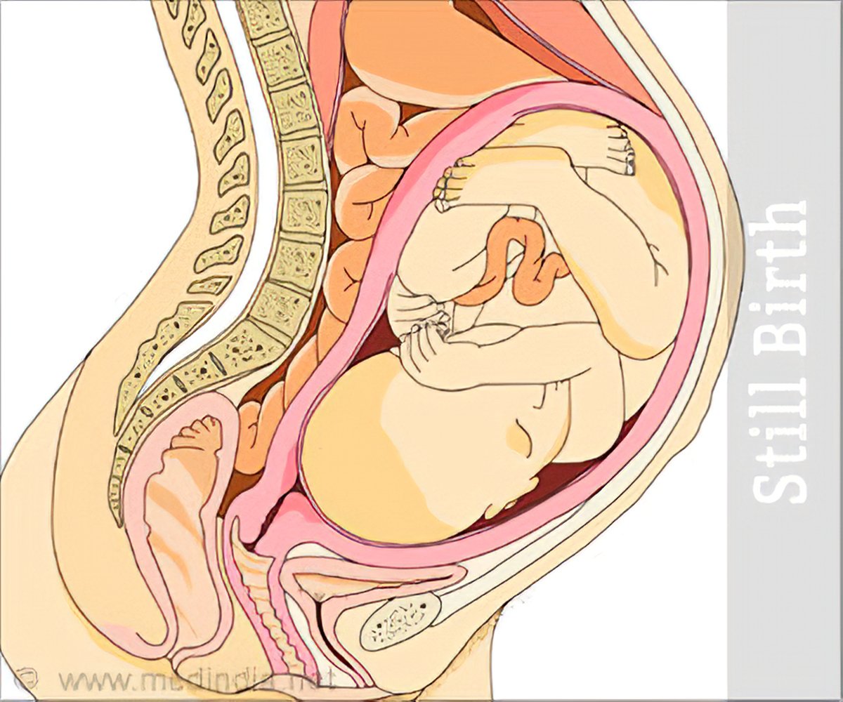 Что такое плацента и какова ее функция. Головное предлежание плода УЗИ. Расположение ребенка в животе. Расположение ребенка в утробе.