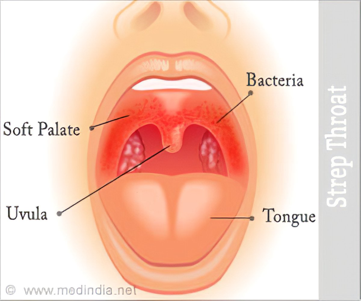 Sore throat sex and oral Sore throat