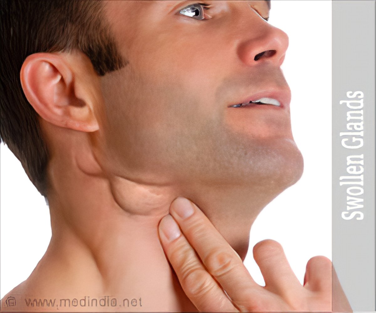 swollen lymph node neck