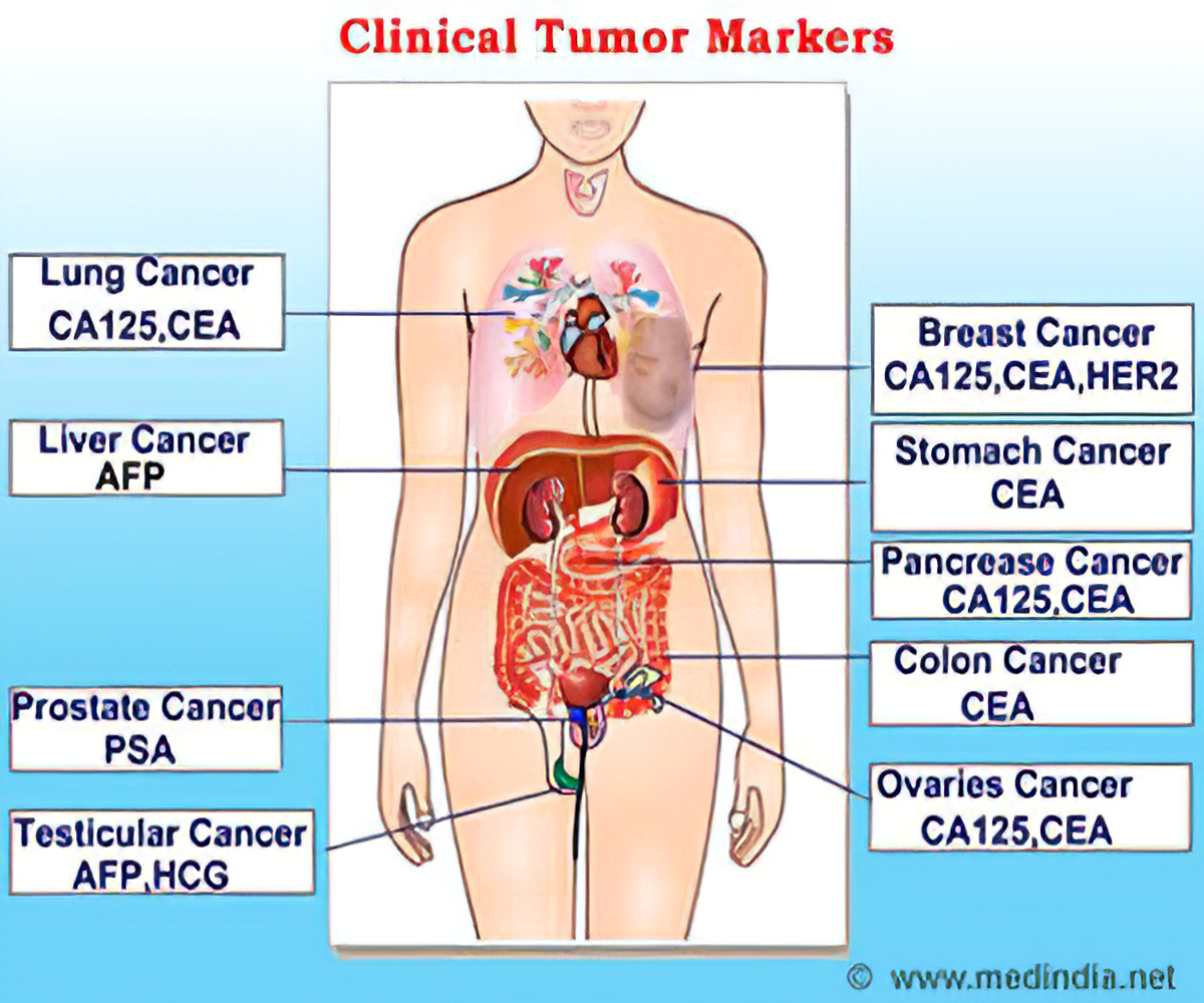 Tumor Markers For Cancer Diagnosis And Prognosis