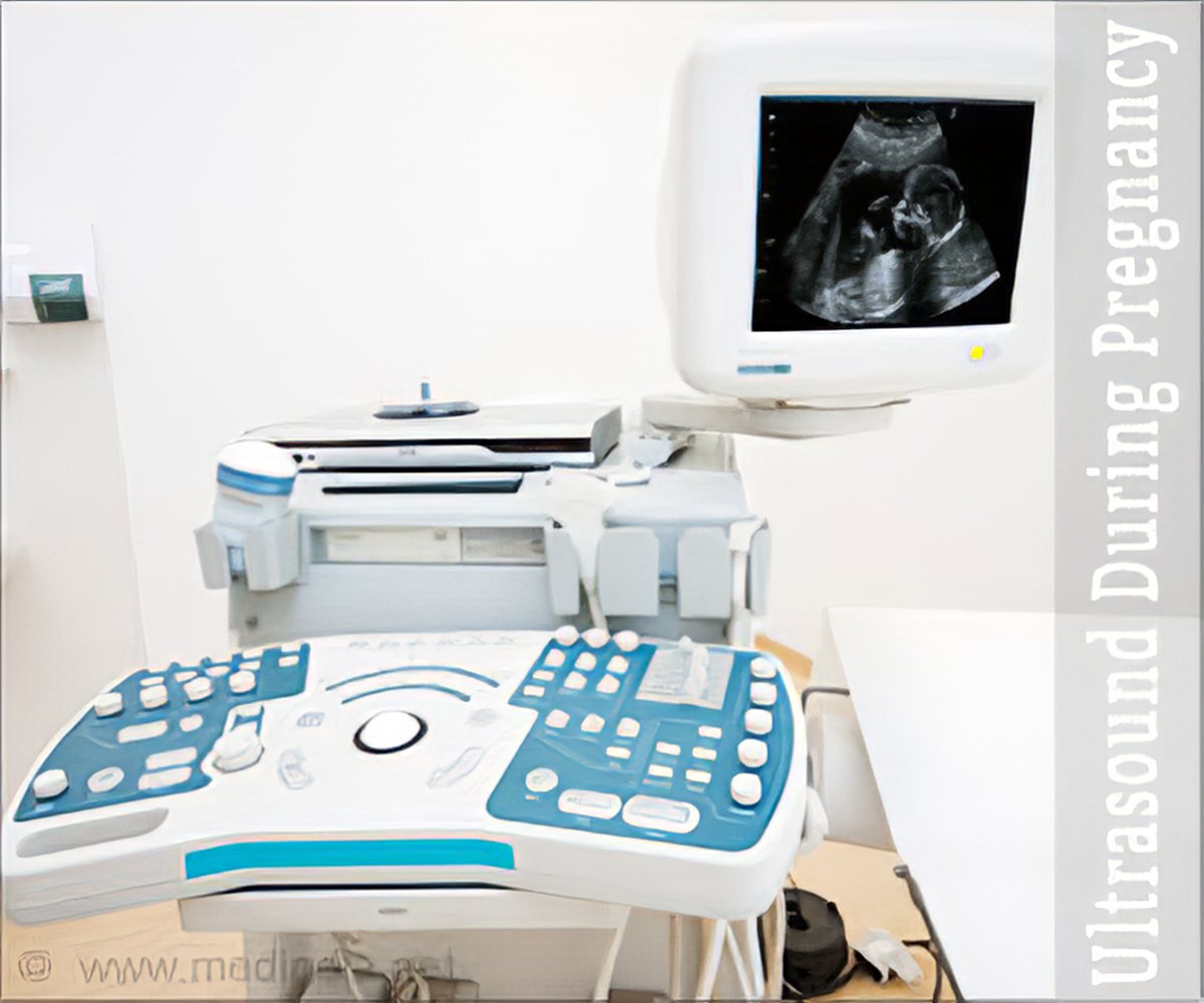 ISUOG Practice Guidelines: performance of firsttrimester fetal ultrasound  scan