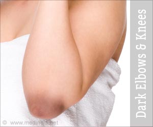 Dark Elbow and Knees - Beauty Tips