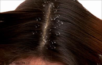 Winter Hair Care: Dandruff Winter Hair Care: Dandruff