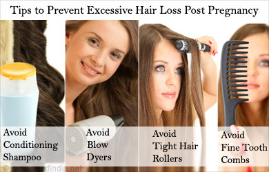 Tip to Prevent Excessive Hair Loss Tip to Prevent Excessive Hair Loss