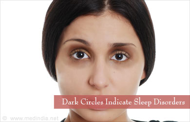 Under Eye Dark Circles Under Eye Dark Circles