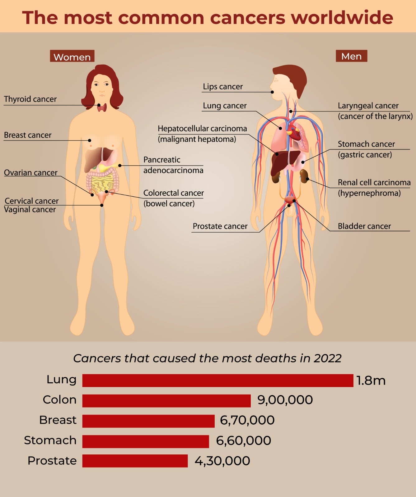 Cancer - Lifetime Risk Cancer - Lifetime Risk