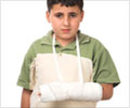 Fracture-First Aid and Emergency Treatment Guide