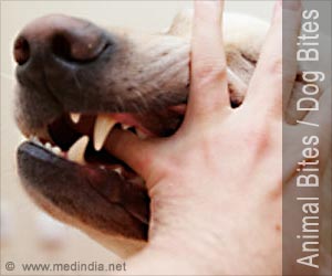 Animal bites / Dog bites - First Aid and Emergency Treatment Guide