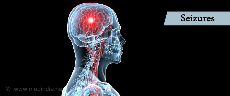 Seizures Brain on Electric Shock