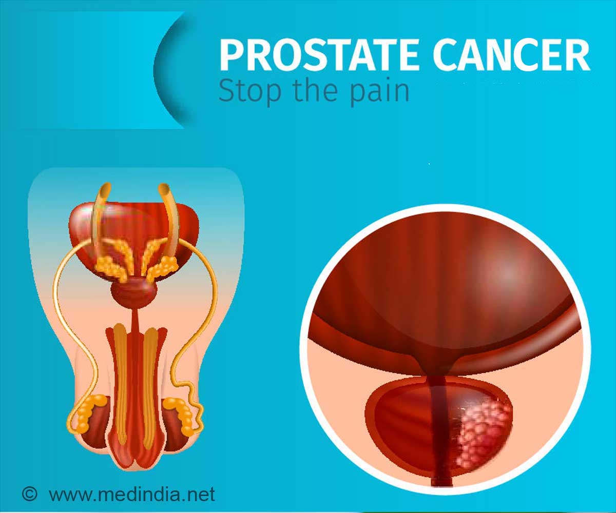 New Procedure for Cancer related Erectile Dysfunction