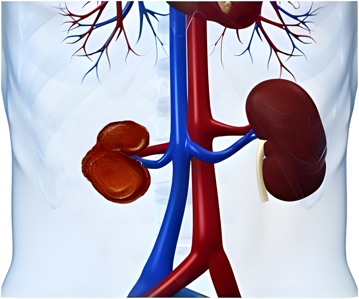 Link Between Kidney Removal and Erectile Dysfunction Identified