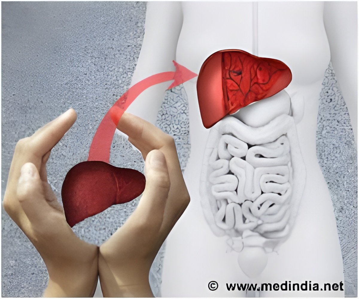 Organ Donors Need to Know All Possible Outcomes of Surgery: Court Organ Donors Need to Know All Possible Outcomes of Surgery: Court