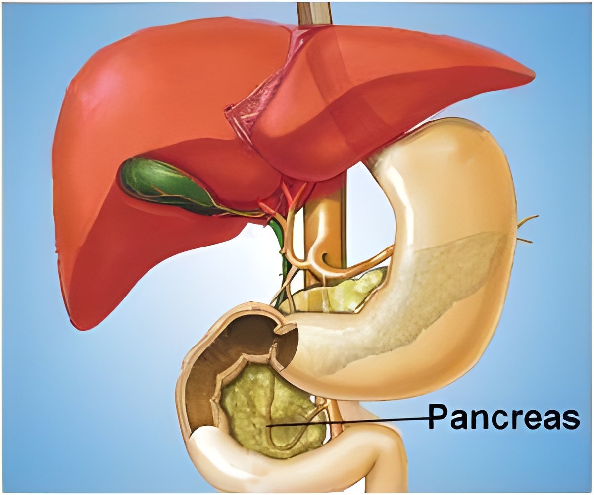 New Therapeutic Target for Pancreatitis and Pancreatic Cancer Discovered New Therapeutic Target for Pancreatitis and Pancreatic Cancer Discovered