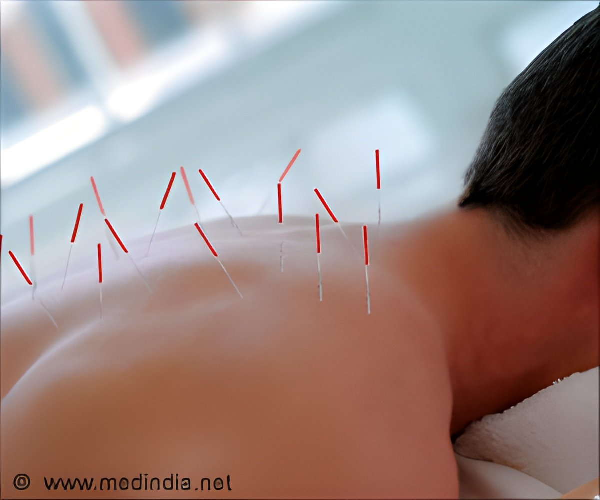 Is Acupuncture For Lower Back Pain Effective?