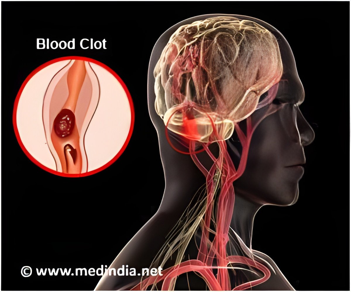 Blood Clots Formation During Wound Healing