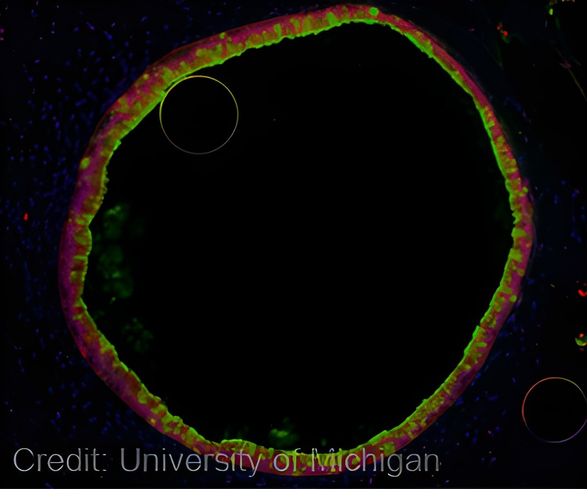 Pandemics Could be Prevented by Insights into How a Bird Flu Virus Spreads Pandemics Could be Prevented by Insights into How a Bird Flu Virus Spreads